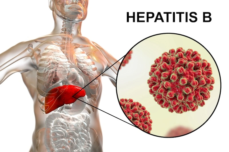Hepatitis B Laboratorio Aclimu
